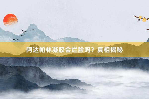 阿达帕林凝胶会烂脸吗？真相揭秘